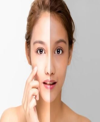 whitening treatment